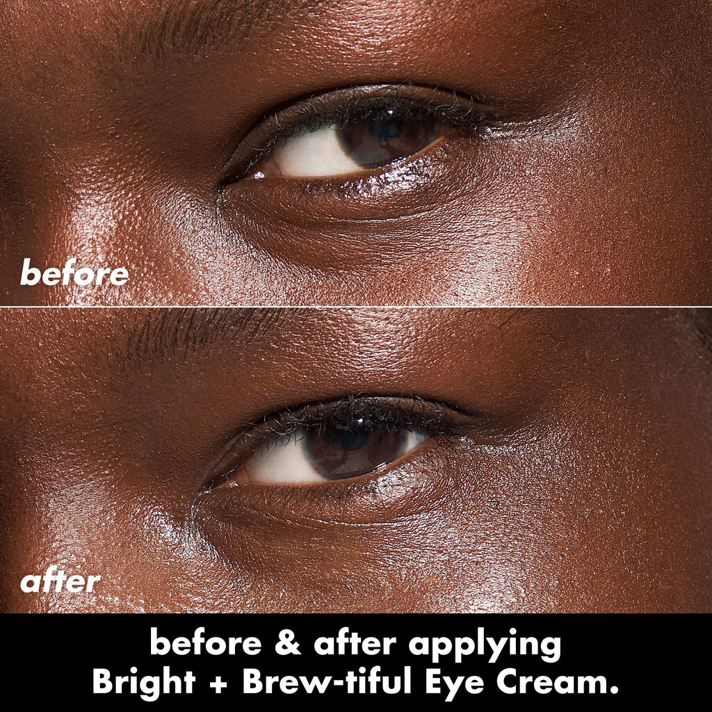 Before and after applying Bright + Brew-Tiful under-eye cream